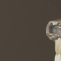 Повече за пародонтологична профилактика 11 от MedicalDent Повече за пародонтологична профилактика 11