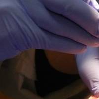 Намерете пародонтологична профилактика 40 от MedicalDent Намерете пародонтологична профилактика 40