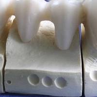 Повече за пародонтологична профилактика 9 от MedicalDent Повече за пародонтологична профилактика 9