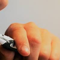 Разнообразие от пародонтологично лечение 11 от MedicalDent Разнообразие от пародонтологично лечение 11