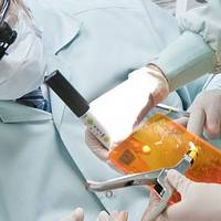 Видове пародонтологично лечение 25 от MedicalDent Видове пародонтологично лечение 25