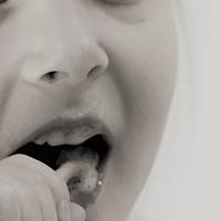 Изберете пародонтологично лечение 29 от MedicalDent Изберете пародонтологично лечение 29