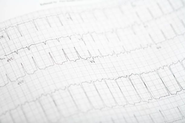 сърцебиене - 13017 бестселъри | medicabilis сърцебиене - 64504 бестселъри